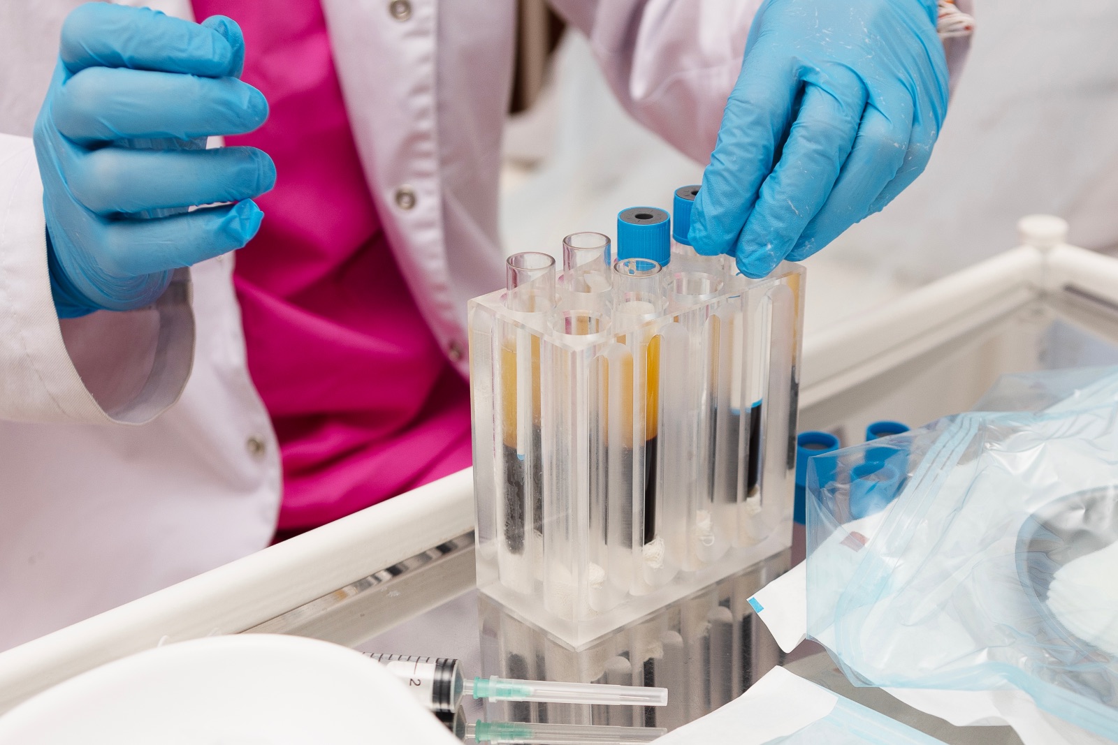 Blood plasma in tubes. Regenerative medicine. Lab technician holding test tube of blood sample after being centrifuged. Non-surgical procedures. Blood taken from patient